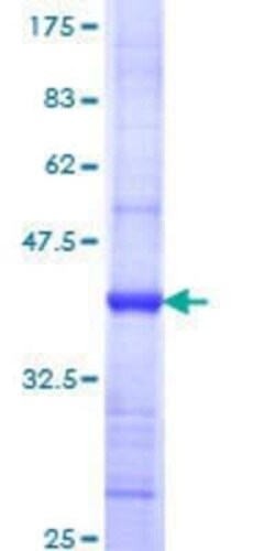 Novus Biologicals Recombinant Human GSPT1 GST (N-Term) Protein 25 &mu;g | Buy Online | Novus Biologicals&trade; | Fisher Scientific