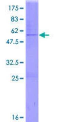 Novus Biologicals Recombinant Human GSTA2 GST (N-Term) Protein 25 &mu;g | Buy Online | Novus Biologicals&trade; | Fisher Scientific
