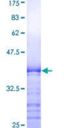 Novus Biologicals Recombinant Human GSTA2 GST (N-Term) Protein 10 &mu;g | Buy Online | Novus Biologicals&trade; | Fisher Scientific