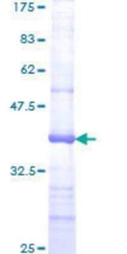 Novus Biologicals Recombinant Human MSH6 GST (N-Term) Protein 10 &mu;g | Buy Online | Novus Biologicals&trade; | Fisher Scientific