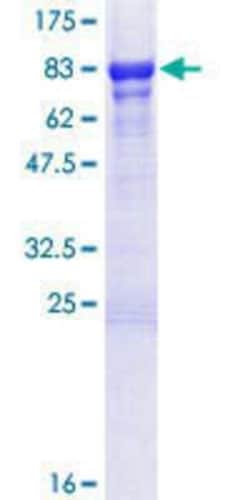 Novus Biologicals Recombinant Human TFIIE-alpha GST (N-Term) Protein 10 &mu;g | Buy Online | Novus Biologicals&trade; | Fisher Scientific