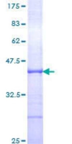 Novus Biologicals Recombinant Human TFIIE-alpha GST (N-Term) Protein 10 &mu;g | Buy Online | Novus Biologicals&trade; | Fisher Scientific