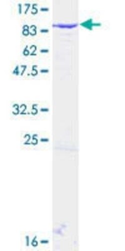 Novus Biologicals Recombinant Human RAP74 GST (N-Term) Protein 25 &mu;g | Buy Online | Novus Biologicals&trade; | Fisher Scientific