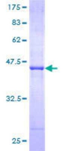 Novus Biologicals Recombinant Human GTF2H2 GST (N-Term) Protein 10 &mu;g | Buy Online | Novus Biologicals&trade; | Fisher Scientific