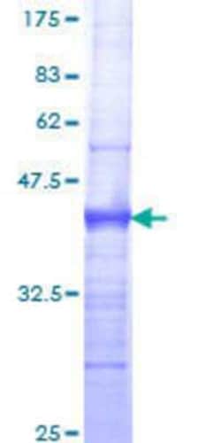 Novus Biologicals Recombinant Human GTF2H3 GST (N-Term) Protein 25 &mu;g | Buy Online | Novus Biologicals&trade; | Fisher Scientific