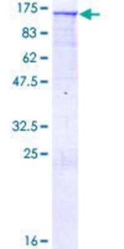 Novus Biologicals Recombinant Human TFII-I GST (N-Term) Protein 2 &mu;g | Buy Online | Novus Biologicals&trade; | Fisher Scientific