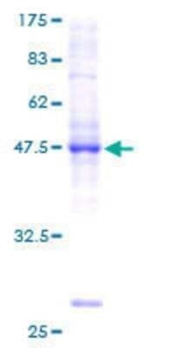 Novus Biologicals Recombinant Human BRF1 GST (N-Term) Protein 2 &mu;g | Buy Online | Novus Biologicals&trade; | Fisher Scientific