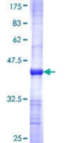 Novus Biologicals Recombinant Human Guanylyl Cyclase alpha 2 GST (N-Term) Protein 25 &mu;g | Buy Online | Novus Biologicals&trade; | Fisher Scientific