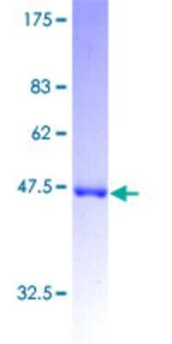 Novus Biologicals Recombinant Human GCAP1 GST (N-Term) Protein 25 &mu;g | Buy Online | Novus Biologicals&trade; | Fisher Scientific