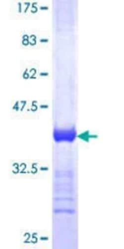 Novus Biologicals Recombinant Human GCAP1 GST (N-Term) Protein 25 &mu;g | Buy Online | Novus Biologicals&trade; | Fisher Scientific