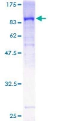 Novus Biologicals Recombinant Human Guanylyl Cyclase beta 1 GST (N-Term) Protein 25 &mu;g | Buy Online | Novus Biologicals&trade; | Fisher Scientific