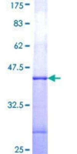 Novus Biologicals Recombinant Human GUCY2F GST (N-Term) Protein 25 &mu;g | Buy Online | Novus Biologicals&trade; | Fisher Scientific