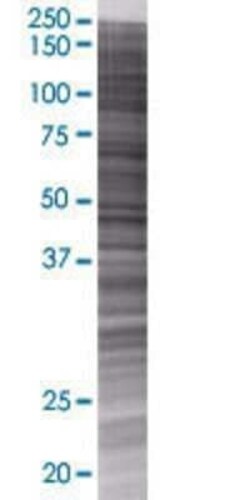 Novus Biologicals Glycogenin 1 293T Cell Transient Overexpression Lysate 0.1 mL | Buy Online | Novus Biologicals&trade; | Fisher Scientific