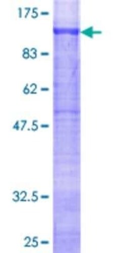 Novus Biologicals Recombinant Human Glycogen Synthase GST (N-Term) Protein 10 &mu;g | Buy Online | Novus Biologicals&trade; | Fisher Scientific