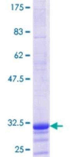 Novus Biologicals Recombinant Human H1F0 GST (N-Term) Protein 25 &mu;g | Buy Online | Novus Biologicals&trade; | Fisher Scientific