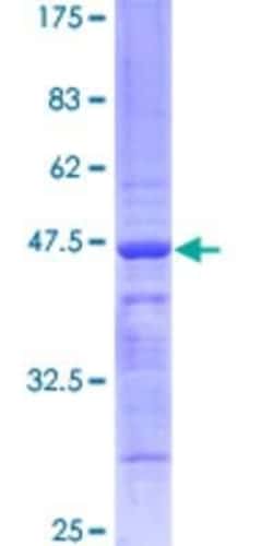 Novus Biologicals Recombinant Human Histone H2AX GST (N-Term) Protein 2 &mu;g | Buy Online | Novus Biologicals&trade; | Fisher Scientific