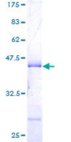 Novus Biologicals Recombinant Human Histone H3.3B GST (N-Term) Protein 25 &mu;g | Buy Online | Novus Biologicals&trade; | Fisher Scientific