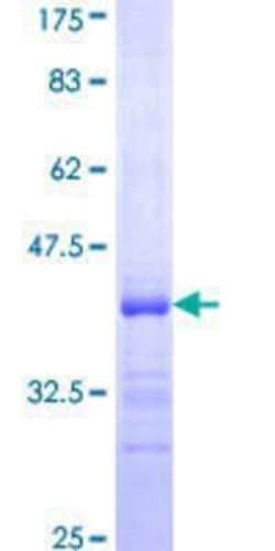 Novus Biologicals Recombinant Human HABP2 GST (N-Term) Protein 25 &mu;g | Buy Online | Novus Biologicals&trade; | Fisher Scientific