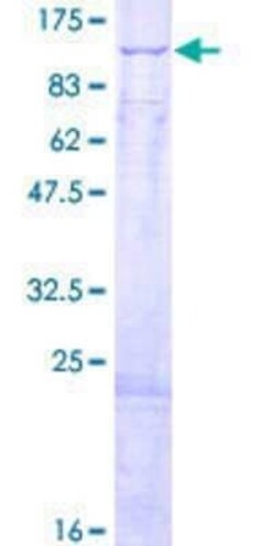 Novus Biologicals Recombinant Human HADHA GST (N-Term) Protein 2 &mu;g | Buy Online | Novus Biologicals&trade; | Fisher Scientific