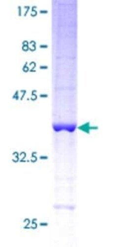 Novus Biologicals Recombinant Human Hemoglobin epsilon GST (N-Term) Protein 10 &mu;g | Buy Online | Novus Biologicals&trade; | Fisher Scientific