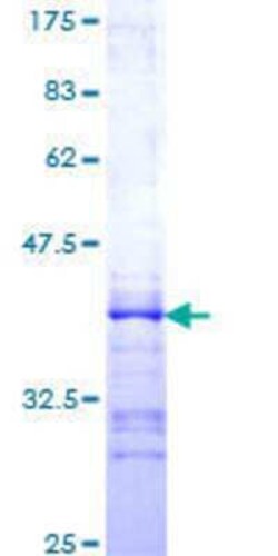 Novus Biologicals Recombinant Human Hck GST (N-Term) Protein 25 &mu;g | Buy Online | Novus Biologicals&trade; | Fisher Scientific