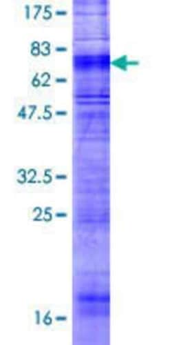 Novus Biologicals Recombinant Human Orexin R1/HCRTR1 GST (N-Term) Protein 2 &mu;g | Buy Online | Novus Biologicals&trade; | Fisher Scientific