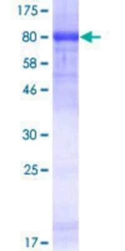 Novus Biologicals Recombinant Human HDAC1 GST (N-Term) Protein 10 &mu;g | Buy Online | Novus Biologicals&trade; | Fisher Scientific