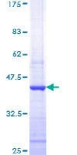 Novus Biologicals Recombinant Human HDAC1 GST (N-Term) Protein 25 &mu;g | Buy Online | Novus Biologicals&trade; | Fisher Scientific