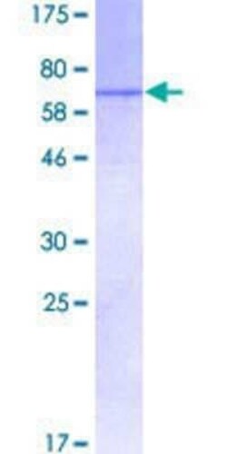 Novus Biologicals Recombinant Human SMARCA6 GST (N-Term) Protein 25 &mu;g | Buy Online | Novus Biologicals&trade; | Fisher Scientific