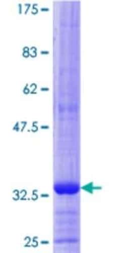 Novus Biologicals Recombinant Human HGD GST (N-Term) Protein 10 &mu;g | Buy Online | Novus Biologicals&trade; | Fisher Scientific