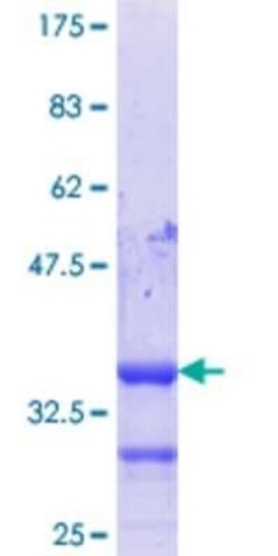 Novus Biologicals Recombinant Human HIC1 GST (N-Term) Protein 25 &mu;g | Buy Online | Novus Biologicals&trade; | Fisher Scientific