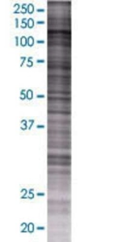 Novus Biologicals HIP1 293T Cell Transient Overexpression Lysate 0.1 mL | Buy Online | Novus Biologicals&trade; | Fisher Scientific