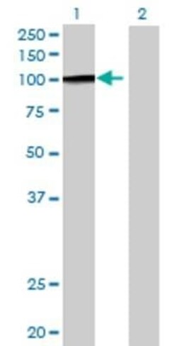 Novus Biologicals HIP1 293T Cell Transient Overexpression Lysate 0.1 mL | Buy Online | Novus Biologicals&trade; | Fisher Scientific