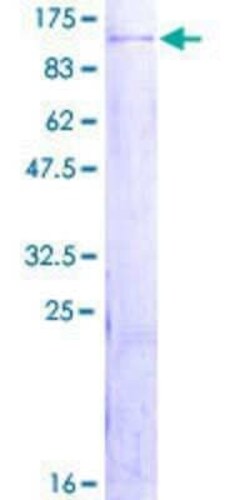 Novus Biologicals Recombinant Human ZBTB48 GST (N-Term) Protein 2 &mu;g | Buy Online | Novus Biologicals&trade; | Fisher Scientific