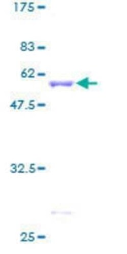 Novus Biologicals Recombinant Human HLA DPA GST (N-Term) Protein 2 &mu;g | Buy Online | Novus Biologicals&trade; | Fisher Scientific