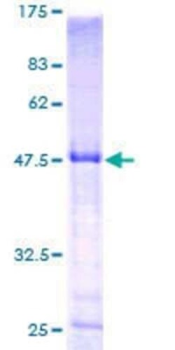 Novus Biologicals™ Recombinant Human HLA DPB1 GST (N-Term) Protein