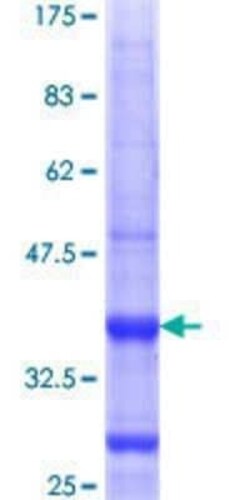 Novus Biologicals™ Recombinant Human HLA DQA1 GST (N-Term) Protein