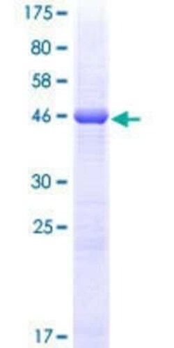 Novus Biologicals Recombinant Human HLA DQB2 GST (N-Term) Protein 25 &mu;g | Buy Online | Novus Biologicals&trade; | Fisher Scientific