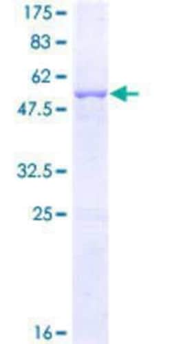 Novus Biologicals™ Recombinant Human HLA DRB3 GST (N-Term) Protein