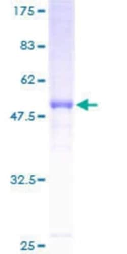 Novus Biologicals™ Recombinant Human HLA DRB4 GST (N-Term) Protein