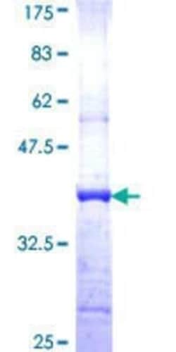 Novus Biologicals Recombinant Human HLCS GST (N-Term) Protein 10 &mu;g | Buy Online | Novus Biologicals&trade; | Fisher Scientific