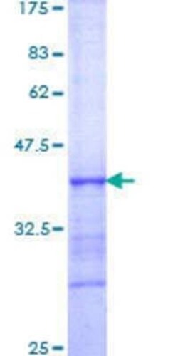 Novus Biologicals Recombinant Human HLX1 GST (N-Term) Protein 10 &mu;g | Buy Online | Novus Biologicals&trade; | Fisher Scientific