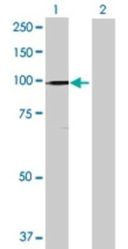 Novus Biologicals HMG-CoA Reductase/HMGCR 293T Cell Transient Overexpression Lysate 0.1 mL | Buy Online | Novus Biologicals&trade; | Fisher Scientific