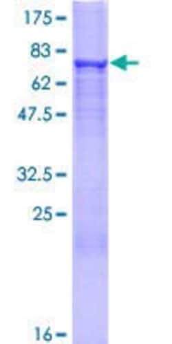 Novus Biologicals™ Recombinant Human HMGCS2 GST (N-Term) Protein