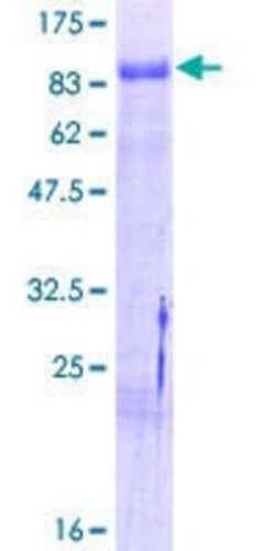 Novus Biologicals Recombinant Human NGFI-B alpha/Nur77/NR4A1 GST (N-Term) Protein 10 &mu;g | Buy Online | Novus Biologicals&trade; | Fisher Scientific