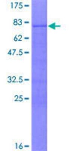 Novus Biologicals Recombinant Human HNF-3 beta/FoxA2 GST (N-Term) Protein 2 &mu;g | Buy Online | Novus Biologicals&trade; | Fisher Scientific