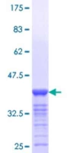 Novus Biologicals Recombinant Human FOXA3 GST (N-Term) Protein 25 &mu;g | Buy Online | Novus Biologicals&trade; | Fisher Scientific