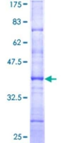 Novus Biologicals Recombinant Human HNF-4 alpha/NR2A1 GST (N-Term) Protein 10 &mu;g | Buy Online | Novus Biologicals&trade; | Fisher Scientific