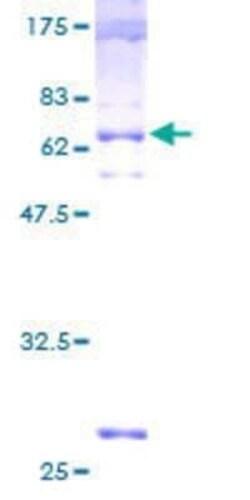 Novus Biologicals Recombinant Human ENT2 GST (N-Term) Protein 2 &mu;g | Buy Online | Novus Biologicals&trade; | Fisher Scientific