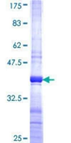 Novus Biologicals Recombinant Human HOXA4 GST (N-Term) Protein 10 &mu;g | Buy Online | Novus Biologicals&trade; | Fisher Scientific